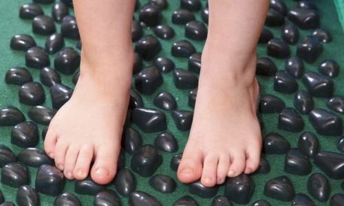 pediatric flatfoot
